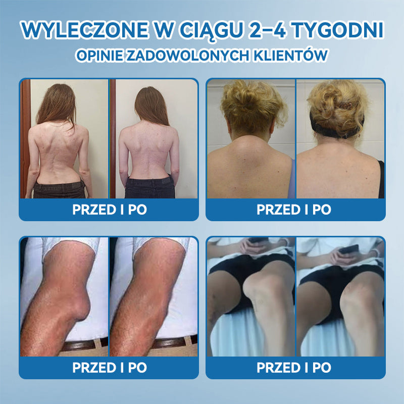 𝑃𝒊𝒄𝐝𝐨® B𝑷𝑪-157 Krem do leczenia stawów 🦴 𝐋𝐞𝐜𝐳𝐞𝐧𝐢𝐞 𝐳𝐚𝐩𝐚𝐥𝐞𝐧𝐢𝐚 𝐬𝐭𝐚𝐰ó𝐰,  𝒏𝒆𝒖𝒓𝒐𝒑𝒂𝒕𝒊𝒊, 𝒓𝒆𝒖𝒎𝒂𝒕𝒚𝒛𝒎𝒖,𝐮𝐫𝐚𝐳ó𝐰 𝐬𝐩𝐨𝐫𝐭𝐨𝐰𝐲𝐜𝐡 𝐢 𝐧𝐢𝐞 𝐭𝐲𝐥𝐤𝐨🍀