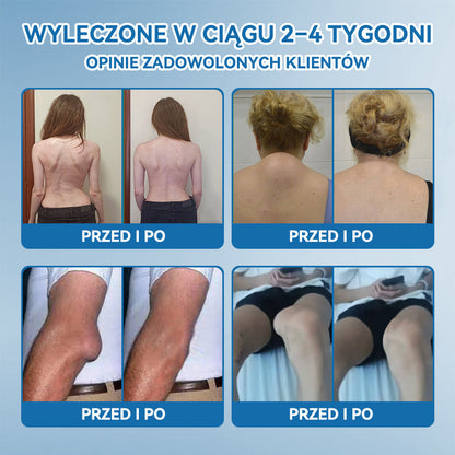 𝑃𝒊𝒄𝐝𝐨® B𝑷𝑪-157 Krem do leczenia stawów 🦴 𝐋𝐞𝐜𝐳𝐞𝐧𝐢𝐞 𝐳𝐚𝐩𝐚𝐥𝐞𝐧𝐢𝐚 𝐬𝐭𝐚𝐰ó𝐰,  𝒏𝒆𝒖𝒓𝒐𝒑𝒂𝒕𝒊𝒊, 𝒓𝒆𝒖𝒎𝒂𝒕𝒚𝒛𝒎𝒖,𝐮𝐫𝐚𝐳ó𝐰 𝐬𝐩𝐨𝐫𝐭𝐨𝐰𝐲𝐜𝐡 𝐢 𝐧𝐢𝐞 𝐭𝐲𝐥𝐤𝐨🍀