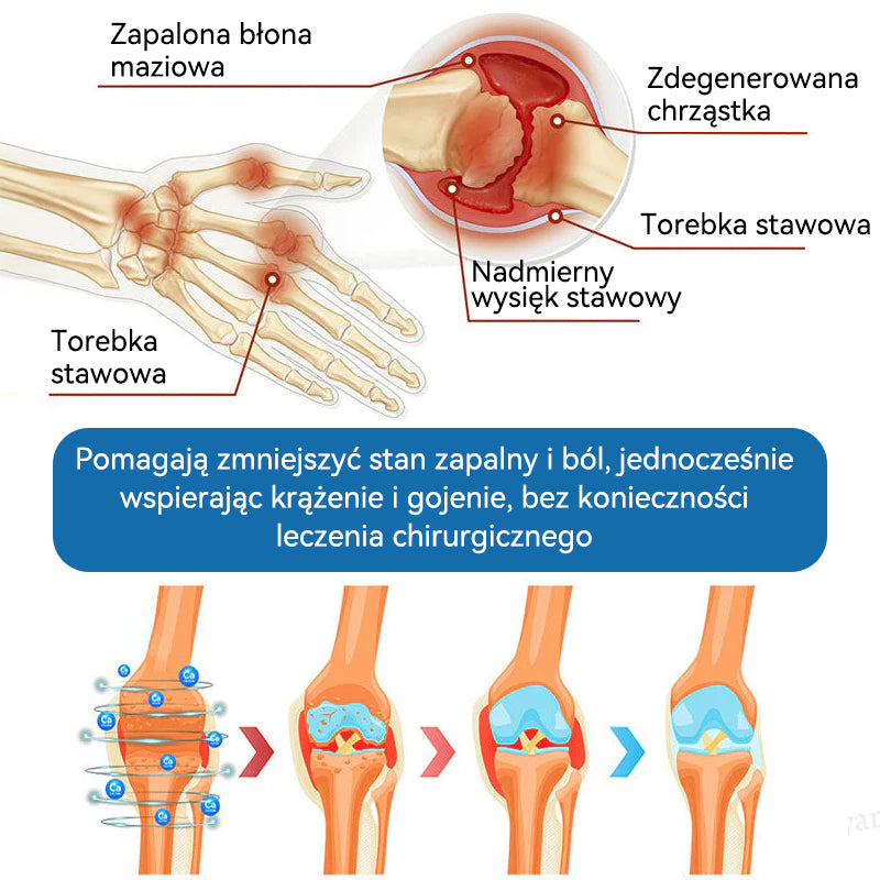 𝑃𝒊𝒄𝐝𝐨® B𝑷𝑪-157 Krem do leczenia stawów 🦴 𝐋𝐞𝐜𝐳𝐞𝐧𝐢𝐞 𝐳𝐚𝐩𝐚𝐥𝐞𝐧𝐢𝐚 𝐬𝐭𝐚𝐰ó𝐰,  𝒏𝒆𝒖𝒓𝒐𝒑𝒂𝒕𝒊𝒊, 𝒓𝒆𝒖𝒎𝒂𝒕𝒚𝒛𝒎𝒖,𝐮𝐫𝐚𝐳ó𝐰 𝐬𝐩𝐨𝐫𝐭𝐨𝐰𝐲𝐜𝐡 𝐢 𝐧𝐢𝐞 𝐭𝐲𝐥𝐤𝐨🍀