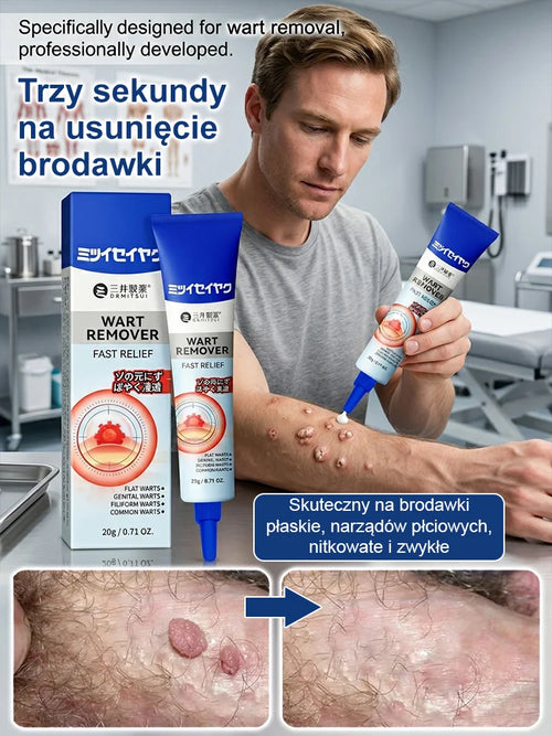 【Trzy sekundy na usunięcie brodawek】🧑‍⚕️Japońska maść Mitsui Pharmaceutical na brodawki