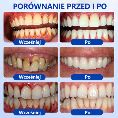 🇪🇺🏅🦷 Evolvion® GumRevive Żel do regeneracji przyzębia⚡