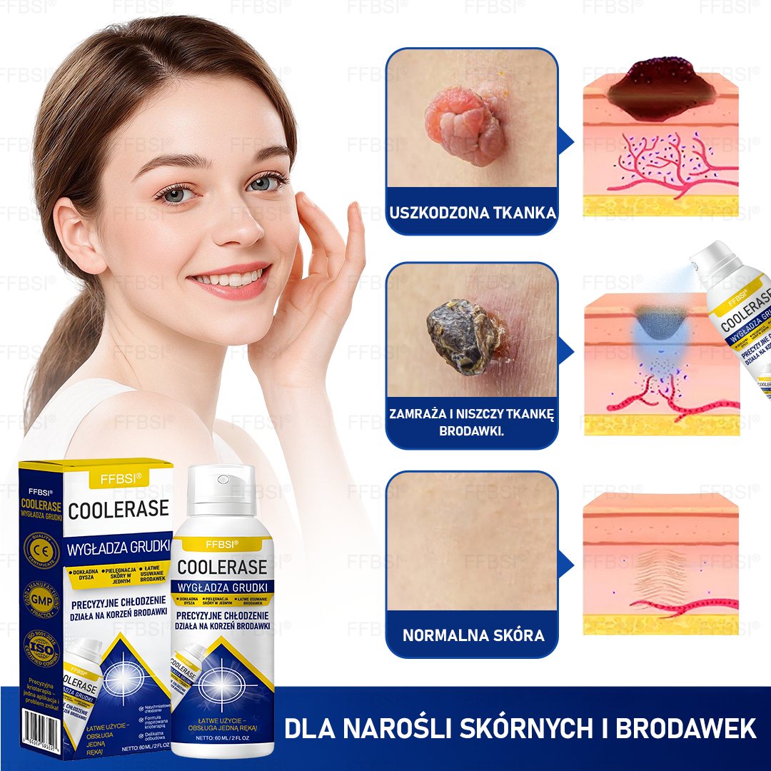 FFBSI®  CoolErase Spray do regeneracji skóry☘️(Brodawe, Pęcherze, Wypryski, Łuszczyca, Zmiany skórne, Trądzik, Skórne narośle, Blizny, Pieprzyki)