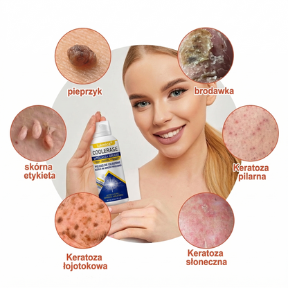 𝗹𝘂𝙠𝙢𝙡𝙘𝙖® 𝑪𝒐𝒐𝒍𝑬𝒓𝒂𝒔𝒆 𝑺𝒑𝒓𝒂𝒚 𝒅𝒐 𝒓𝒆𝒈𝒆𝒏𝒆𝒓𝒂𝒄𝒋𝒊 𝒔𝒌ó𝒓𝒚 🌿(𝑏𝑟𝑜𝑑𝑎𝑤𝑘𝑖, 𝑝ę𝑐ℎ𝑒𝑟𝑧𝑒, 𝑤𝑦𝑠𝑦𝑝𝑘𝑖, ł𝑢𝑠𝑧𝑐𝑧𝑦𝑐𝑎, 𝑝𝑟𝑜𝑏𝑙𝑒𝑚𝑦 𝑠𝑘ó𝑟𝑛𝑒, 𝑡𝑟ą𝑑𝑧𝑖𝑘, 𝑛𝑎𝑟𝑜ś𝑙𝑎 𝑠𝑘ó𝑟𝑛𝑒, 𝑏𝑙𝑖𝑧𝑛𝑦, 𝑧𝑛𝑎𝑚𝑖𝑜𝑛𝑎)🔥