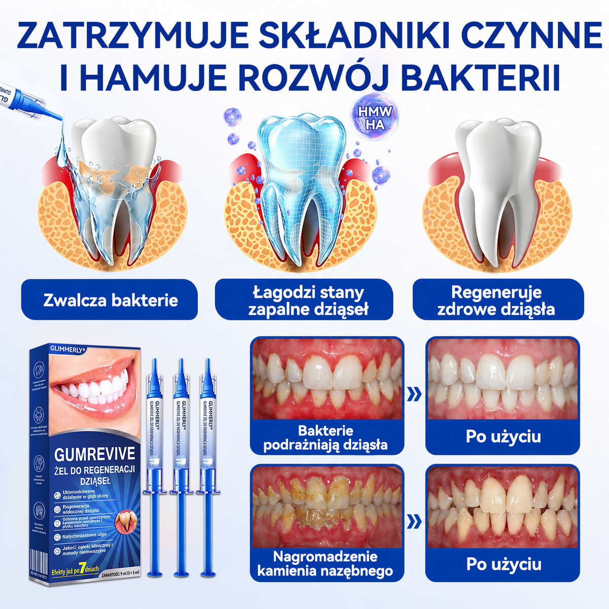 🇪🇺🏅🦷 Evolvion® GumRevive Żel do regeneracji przyzębia⚡