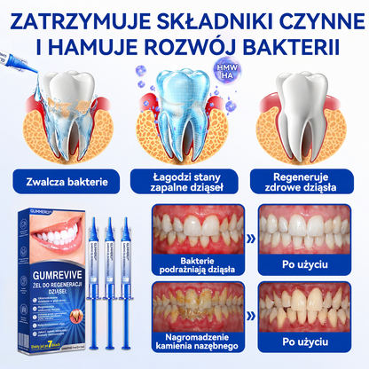 🇪🇺🏅🦷 Evolvion® GumRevive Żel do regeneracji przyzębia⚡