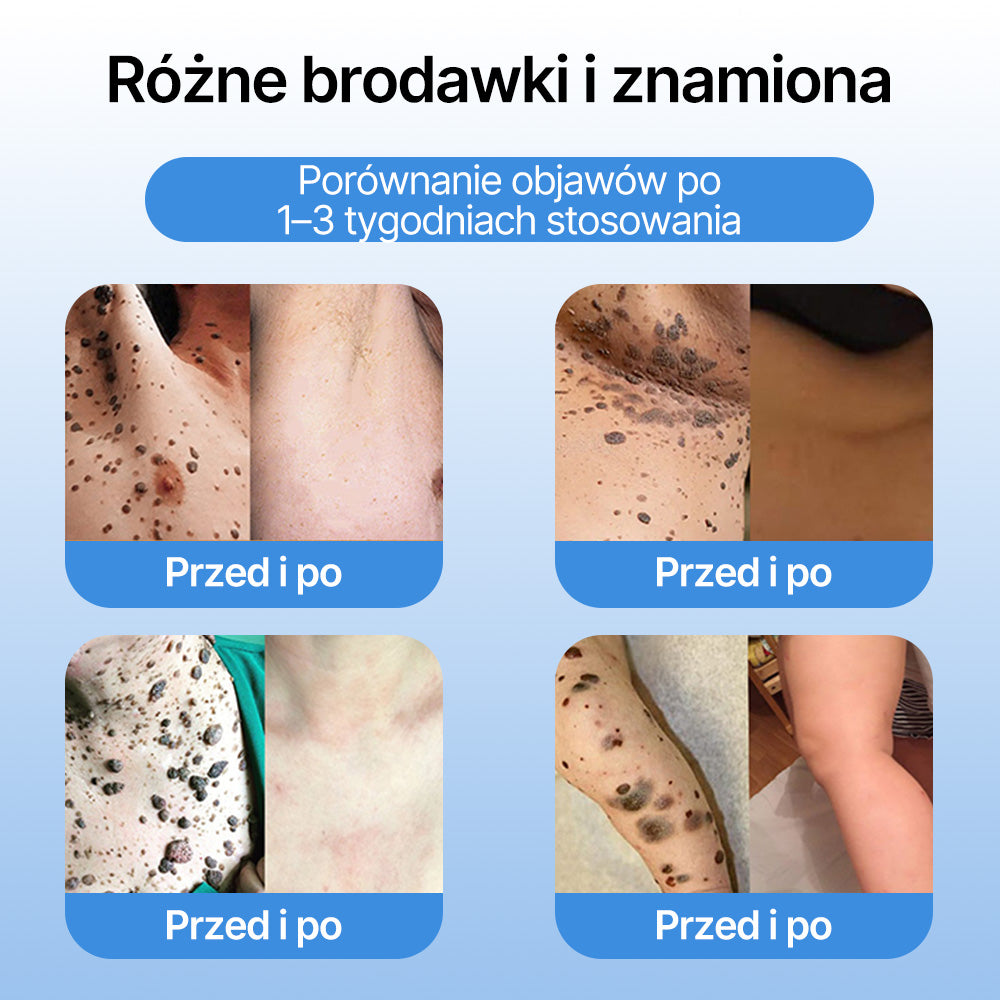 𝗹𝘂𝙠𝙢𝙡𝙘𝙖® 𝑪𝒐𝒐𝒍𝑬𝒓𝒂𝒔𝒆 𝑺𝒑𝒓𝒂𝒚 𝒅𝒐 𝒓𝒆𝒈𝒆𝒏𝒆𝒓𝒂𝒄𝒋𝒊 𝒔𝒌ó𝒓𝒚 🌿(𝑏𝑟𝑜𝑑𝑎𝑤𝑘𝑖, 𝑝ę𝑐ℎ𝑒𝑟𝑧𝑒, 𝑤𝑦𝑠𝑦𝑝𝑘𝑖, ł𝑢𝑠𝑧𝑐𝑧𝑦𝑐𝑎, 𝑝𝑟𝑜𝑏𝑙𝑒𝑚𝑦 𝑠𝑘ó𝑟𝑛𝑒, 𝑡𝑟ą𝑑𝑧𝑖𝑘, 𝑛𝑎𝑟𝑜ś𝑙𝑎 𝑠𝑘ó𝑟𝑛𝑒, 𝑏𝑙𝑖𝑧𝑛𝑦, 𝑧𝑛𝑎𝑚𝑖𝑜𝑛𝑎)🔥