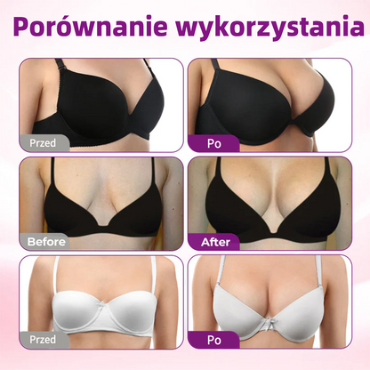 🍒Turonu® 👩‍⚕️ Zaawansowanynano-mikroigłowy plaster do ukierunkowanego powiększania biustu