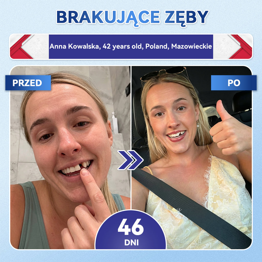 🦷 𝐆𝐥𝐢𝐦𝐦𝐞𝐫𝐥𝐲® 𝐓𝐢𝐝𝐞𝐠𝐥𝐮𝐬𝐢𝐛 Płatki Mikronakłuwające do Naprawy Zębów i Dziąseł | Zaawansowana Aktywacja Komórek Macierzystych – Strips do Naprawy Zębów 🛒