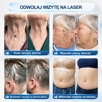 Oficjalny Sklep Markowy | ✅👩‍⚕️ 𝐏i𝐜𝐝o® 7-Dniowy 𝗧𝗮𝗴 & 𝗦𝗽𝗼𝐭 𝐄𝐫𝐚𝐬𝐞𝐫 (Bez bólu, Bez blizn – aplikator z kulką) 🌵