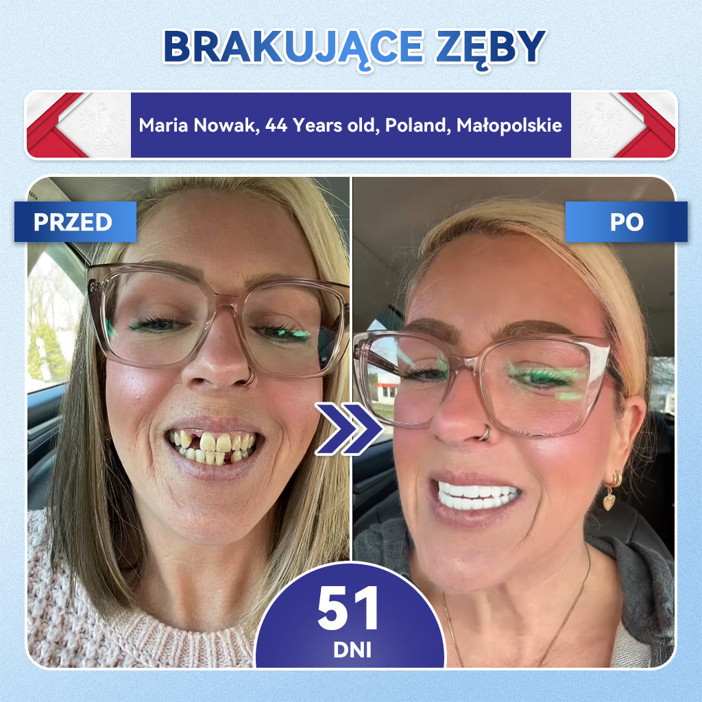 🦷 𝐆𝐥𝐢𝐦𝐦𝐞𝐫𝐥𝐲® 𝐓𝐢𝐝𝐞𝐠𝐥𝐮𝐬𝐢𝐛 Płatki Mikronakłuwające do Naprawy Zębów i Dziąseł | Zaawansowana Aktywacja Komórek Macierzystych – Strips do Naprawy Zębów 🛒