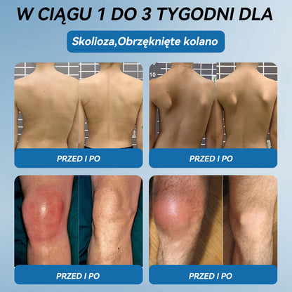 𝑃𝒊𝒄𝐝𝐨® B𝑷𝑪-157 Krem do leczenia stawów 🦴 𝐋𝐞𝐜𝐳𝐞𝐧𝐢𝐞 𝐳𝐚𝐩𝐚𝐥𝐞𝐧𝐢𝐚 𝐬𝐭𝐚𝐰ó𝐰,  𝒏𝒆𝒖𝒓𝒐𝒑𝒂𝒕𝒊𝒊, 𝒓𝒆𝒖𝒎𝒂𝒕𝒚𝒛𝒎𝒖,𝐮𝐫𝐚𝐳ó𝐰 𝐬𝐩𝐨𝐫𝐭𝐨𝐰𝐲𝐜𝐡 𝐢 𝐧𝐢𝐞 𝐭𝐲𝐥𝐤𝐨🍀