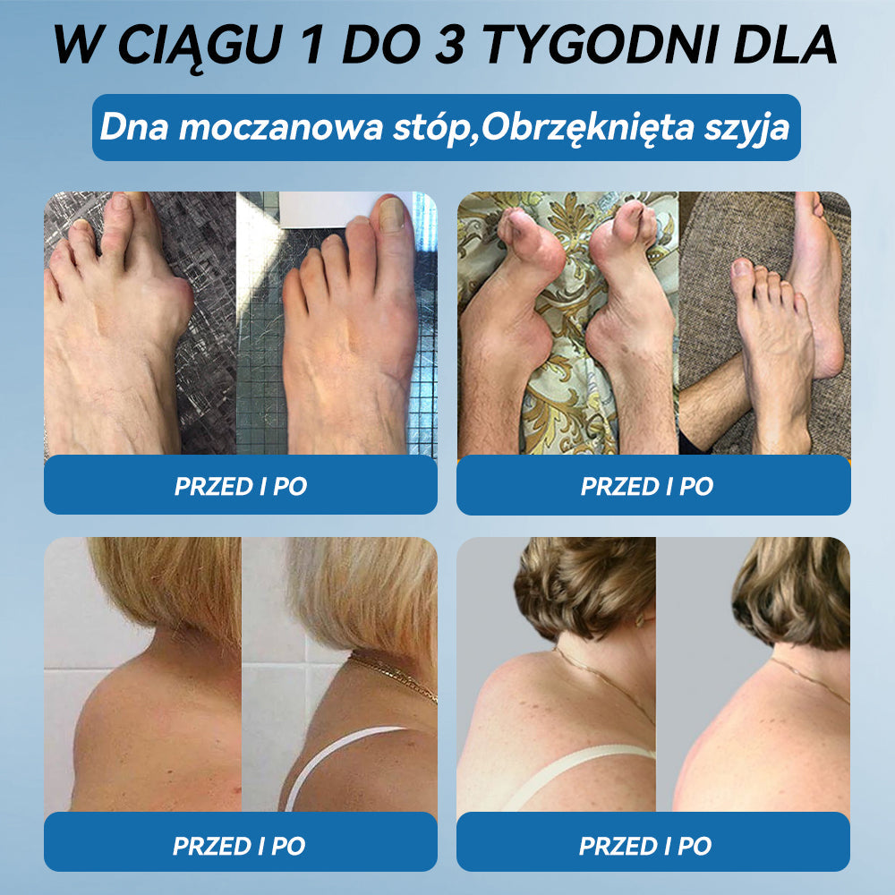 𝑃𝒊𝒄𝐝𝐨® B𝑷𝑪-157 Krem do leczenia stawów 🦴 𝐋𝐞𝐜𝐳𝐞𝐧𝐢𝐞 𝐳𝐚𝐩𝐚𝐥𝐞𝐧𝐢𝐚 𝐬𝐭𝐚𝐰ó𝐰,  𝒏𝒆𝒖𝒓𝒐𝒑𝒂𝒕𝒊𝒊, 𝒓𝒆𝒖𝒎𝒂𝒕𝒚𝒛𝒎𝒖,𝐮𝐫𝐚𝐳ó𝐰 𝐬𝐩𝐨𝐫𝐭𝐨𝐰𝐲𝐜𝐡 𝐢 𝐧𝐢𝐞 𝐭𝐲𝐥𝐤𝐨🍀
