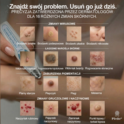 Oficjalny Sklep Markowy | ✅👩‍⚕️ 𝐏i𝐜𝐝o® 7-Dniowy 𝗧𝗮𝗴 & 𝗦𝗽𝗼𝐭 𝐄𝐫𝐚𝐬𝐞𝐫 (Bez bólu, Bez blizn – aplikator z kulką) 🌵