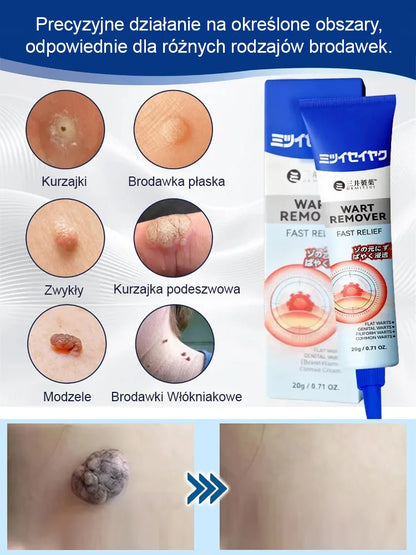 【Trzy sekundy na usunięcie brodawek】🧑‍⚕️Japońska maść Mitsui Pharmaceutical na brodawki