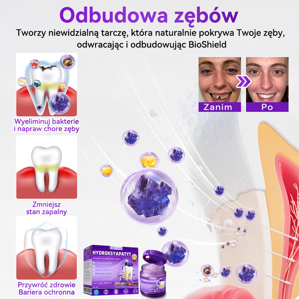 𝑷𝒓𝒐𝒎𝒐𝒄𝒋𝒂 ś𝒘𝒊ą𝒕𝒆𝒄𝒛𝒏𝒂 🌲| 𝑫𝒐𝒓𝒎𝒐𝒓𝒏𝒂® 𝑯𝒚𝒅𝒓𝒐𝒌𝒔𝒚𝒂𝒑𝒂𝒕𝒚𝒕 𝑷𝒓𝒐𝒔𝒛𝒆𝒌 𝒅𝒐 𝑶𝒅𝒃𝒖𝒅𝒐𝒘𝒚 𝒁ę𝒃ó𝒘🦷 𝑳𝒆𝒄𝒛𝒚 𝒑𝒓ó𝒄𝒉𝒏𝒊𝒄ę, 𝒑𝒓𝒐𝒃𝒍𝒆𝒎𝒚 𝒛 𝒅𝒛𝒊ą𝒔ł𝒂𝒎𝒊, 𝒏𝒂𝒅𝒘𝒓𝒂ż𝒍𝒊𝒘𝒐ść 𝒛ę𝒃ó𝒘, 𝒂𝒇𝒕𝒚 𝒐𝒓𝒂𝒛 𝒑𝒓𝒛𝒆𝒃𝒂𝒓𝒘𝒊𝒆𝒏𝒊𝒂 𝒛ę𝒃ó𝒘👨‍⚕️