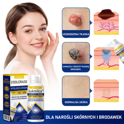 𝗹𝘂𝙠𝙢𝙡𝙘𝙖® 𝑪𝒐𝒐𝒍𝑬𝒓𝒂𝒔𝒆 𝑺𝒑𝒓𝒂𝒚 𝒅𝒐 𝒓𝒆𝒈𝒆𝒏𝒆𝒓𝒂𝒄𝒋𝒊 𝒔𝒌ó𝒓𝒚 🌿(𝑏𝑟𝑜𝑑𝑎𝑤𝑘𝑖, 𝑝ę𝑐ℎ𝑒𝑟𝑧𝑒, 𝑤𝑦𝑠𝑦𝑝𝑘𝑖, ł𝑢𝑠𝑧𝑐𝑧𝑦𝑐𝑎, 𝑝𝑟𝑜𝑏𝑙𝑒𝑚𝑦 𝑠𝑘ó𝑟𝑛𝑒, 𝑡𝑟ą𝑑𝑧𝑖𝑘, 𝑛𝑎𝑟𝑜ś𝑙𝑎 𝑠𝑘ó𝑟𝑛𝑒, 𝑏𝑙𝑖𝑧𝑛𝑦, 𝑧𝑛𝑎𝑚𝑖𝑜𝑛𝑎)🔥