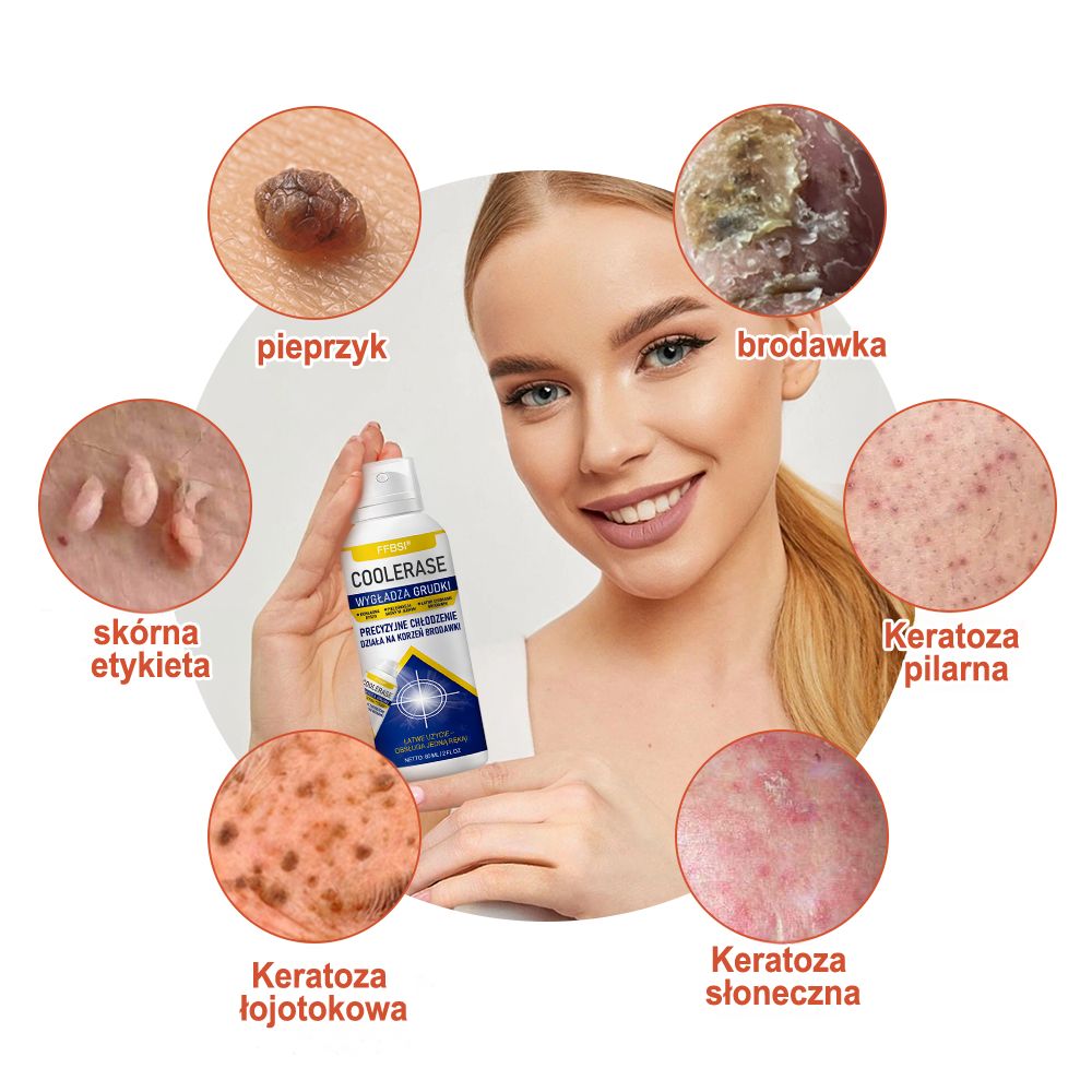 FFBSI®  CoolErase Spray do regeneracji skóry☘️(Brodawe, Pęcherze, Wypryski, Łuszczyca, Zmiany skórne, Trądzik, Skórne narośle, Blizny, Pieprzyki)