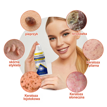 FFBSI®  CoolErase Spray do regeneracji skóry☘️(Brodawe, Pęcherze, Wypryski, Łuszczyca, Zmiany skórne, Trądzik, Skórne narośle, Blizny, Pieprzyki)